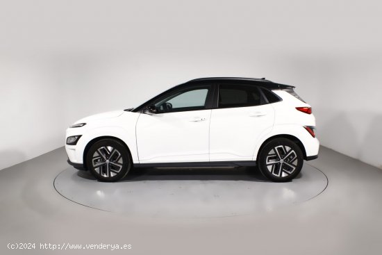 Hyundai Kona BEV 150KW TECNO 2-TONE 5P - 