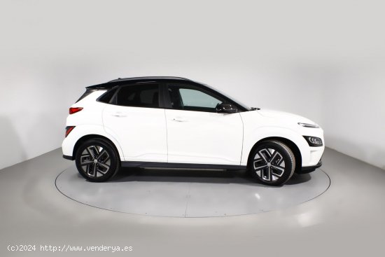 Hyundai Kona BEV 150KW TECNO 2-TONE 5P - 