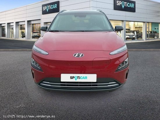 Hyundai Kona  150kW EV  2C Tecno - 